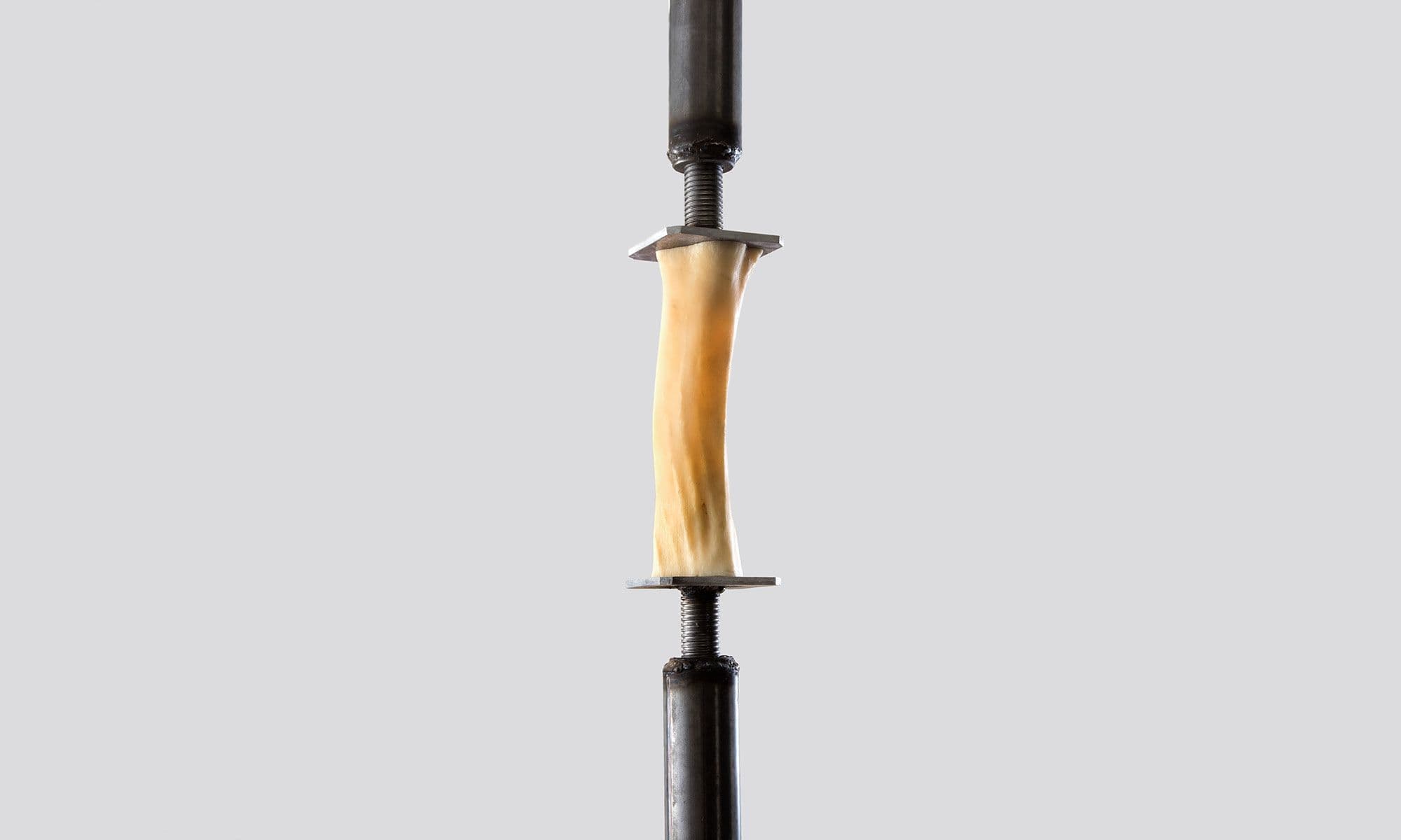 Bone sandwiched between two metal pieces